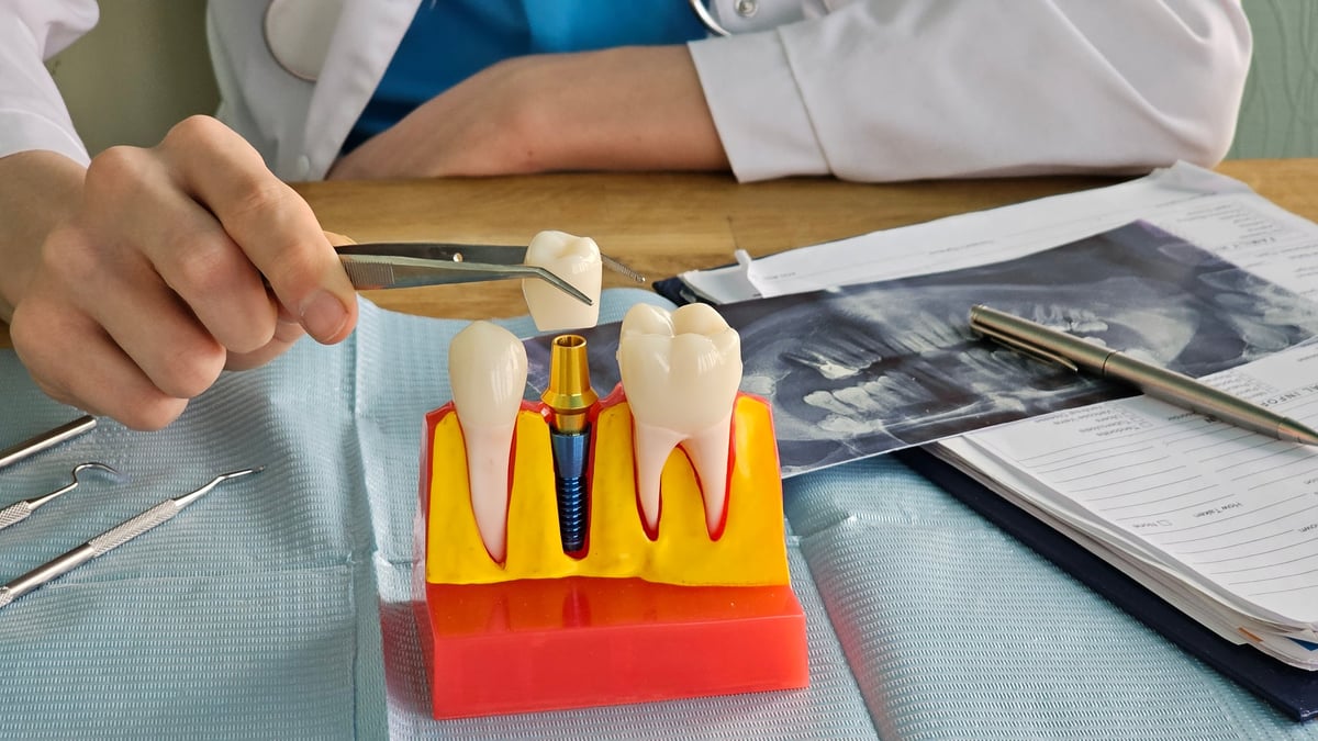 Dentist holds tool above dental model during examination in clinic with dental charts on table