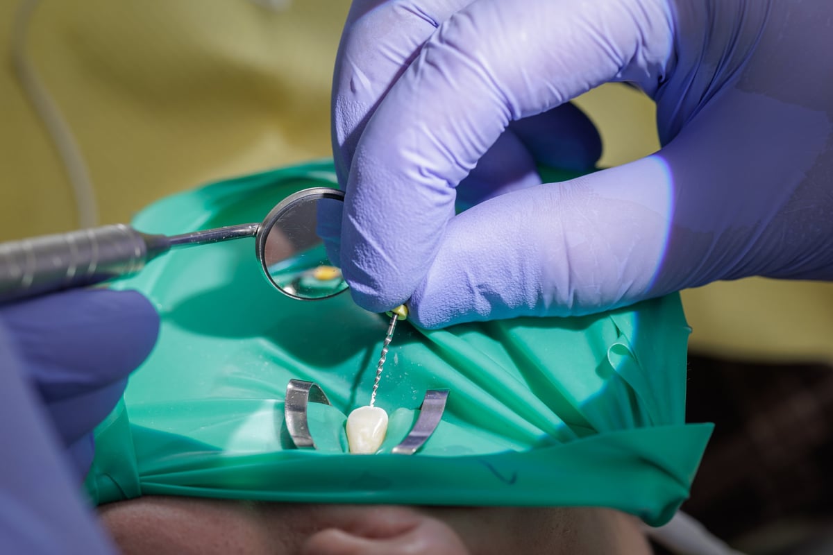 Closeup of dentist hands using endodontic file and mirror during root canal therapy with rubber dam. Concept of modern dental surgery, sterile procedure and tooth preservation.