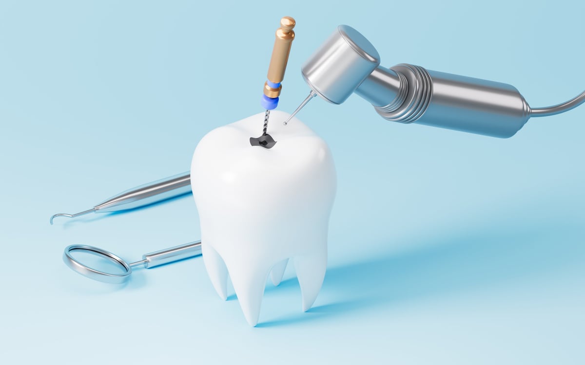 Human teeth root canal treatment process. 3d rendering. 3d illustration.
