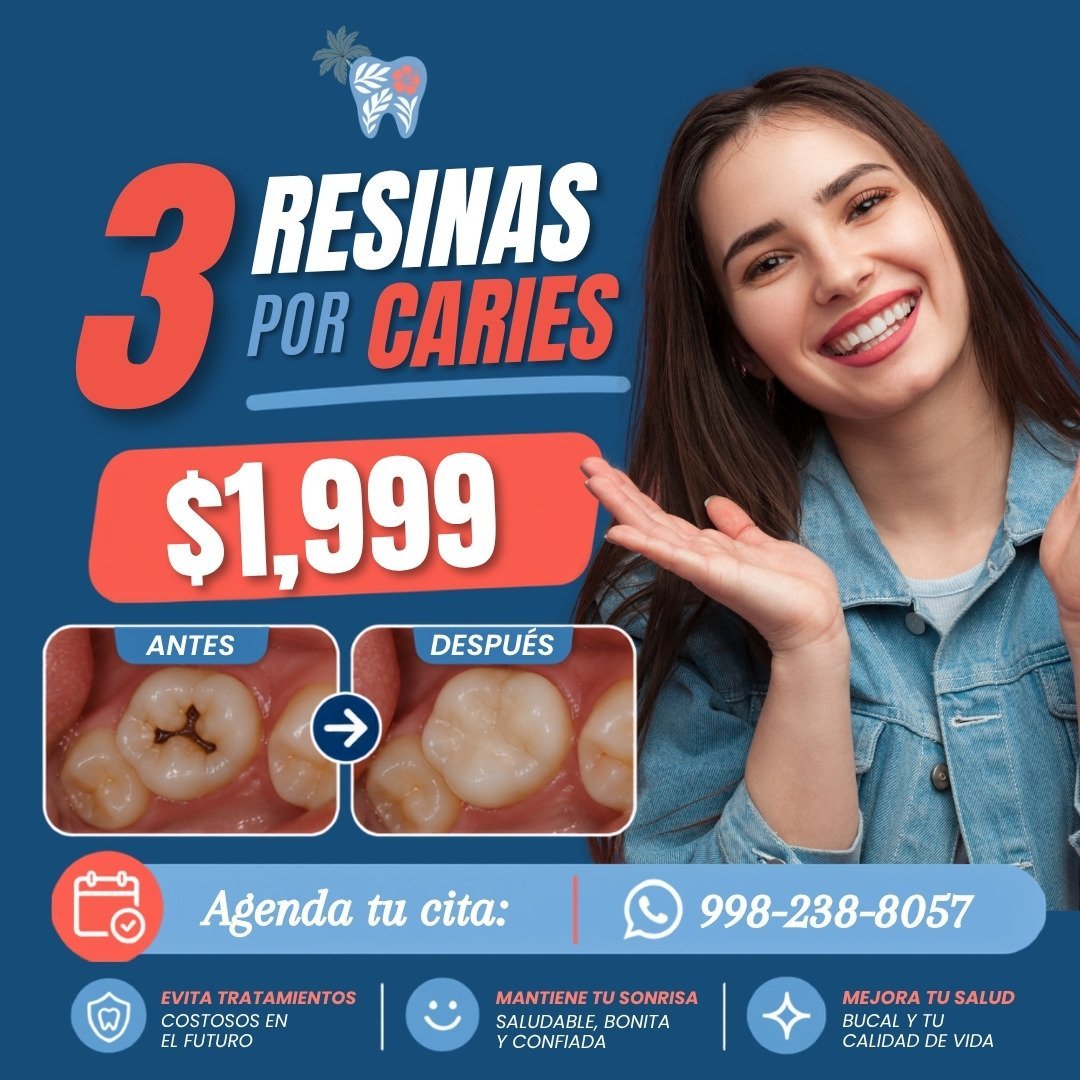 Promoción 3 caries $1,999