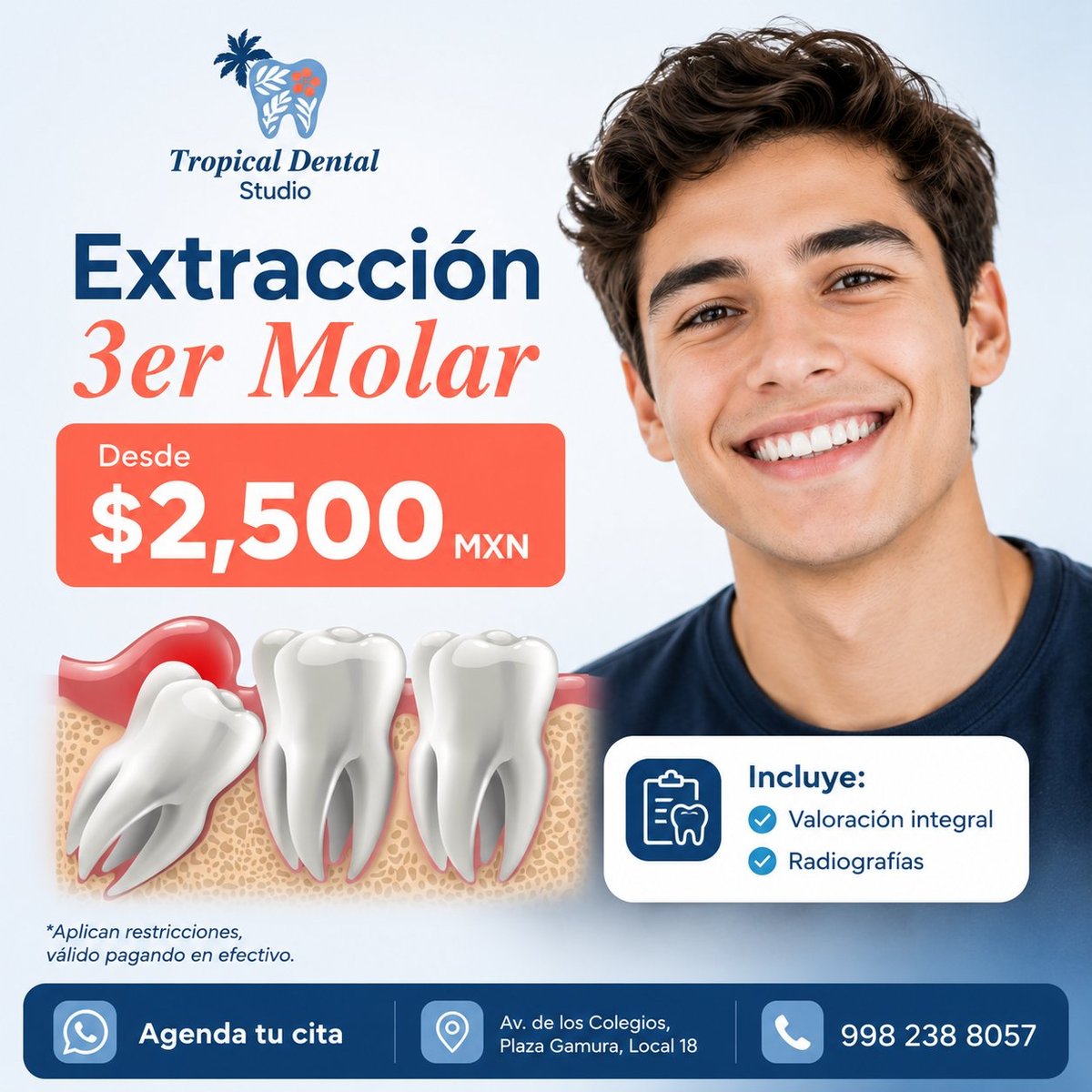 Tropical Dental Studio promotion for third molar extraction starting at $2,500 MXN, includes dental evaluation and radiographs