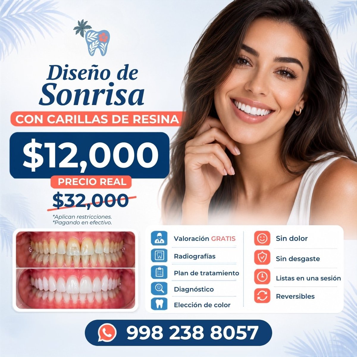 Smile makeover dental advertisement showing before and after teeth with pricing and features in Spanish