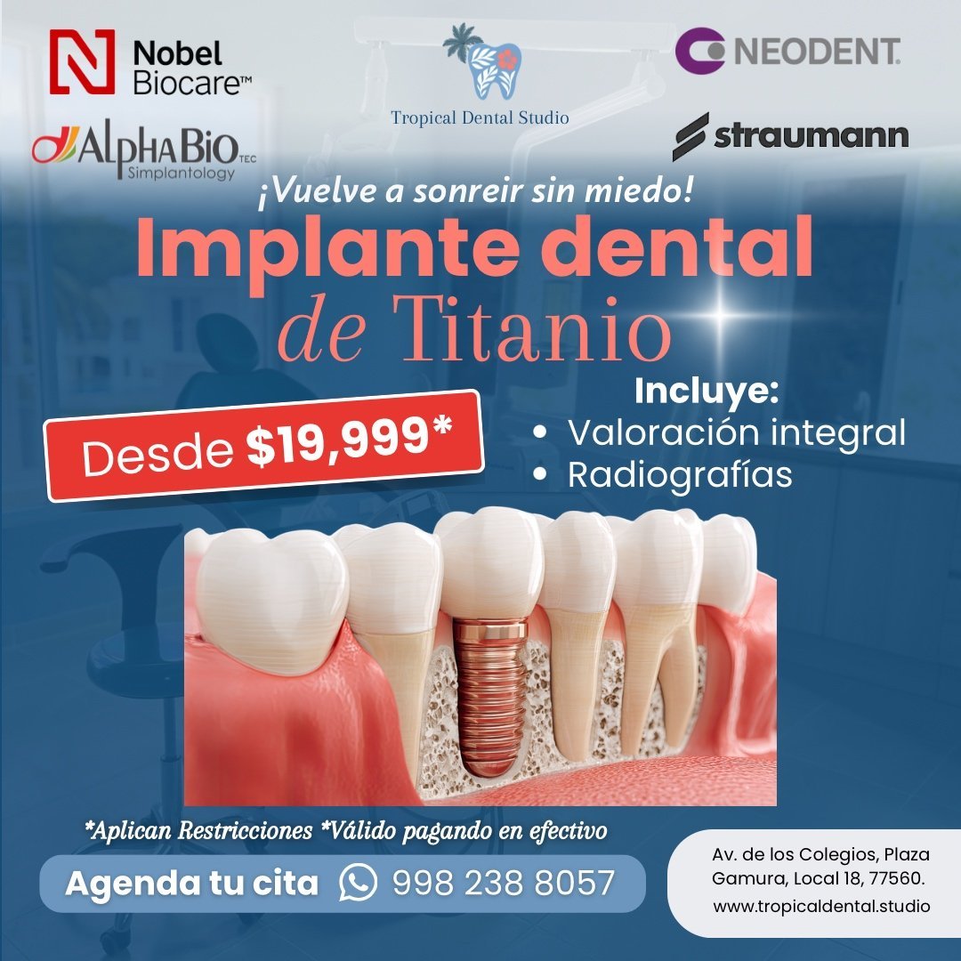Dental implant promotional ad featuring titanium implant with pricing from $19,999, includes evaluation and X-rays, WhatsApp contact number