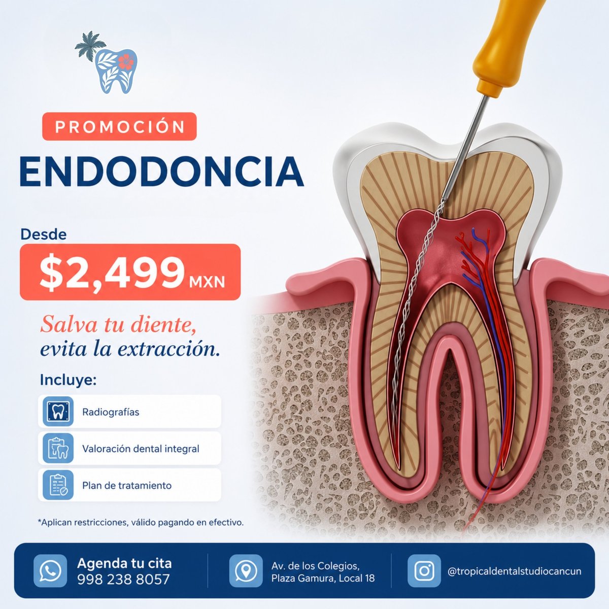 Endodoncia dental promotion poster showing root canal treatment cross-section at $2,499 MXN with treatment plan details